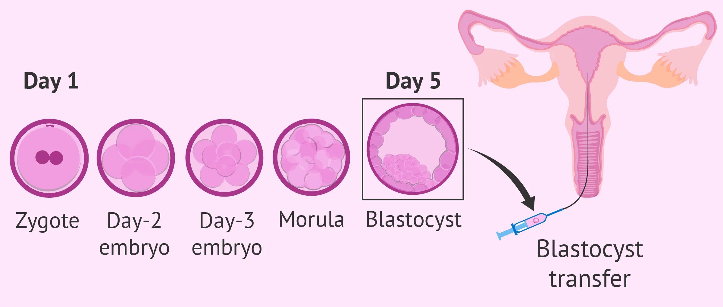 culture-to-blastocyst-transfer.jpg